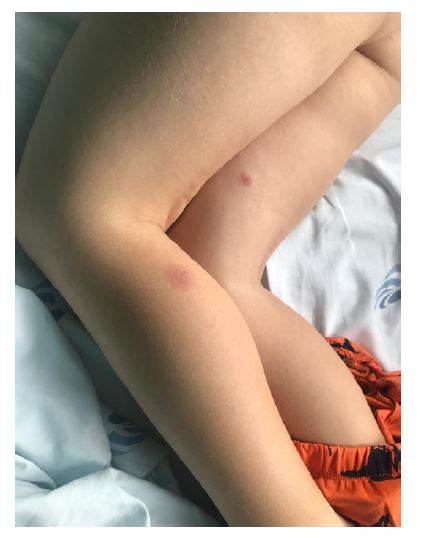 Plect Dermatology clinical case