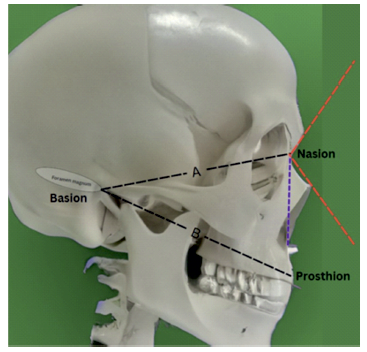 Naison Inion Nosing beyond the stone age: deciphering nasal evolution from ...